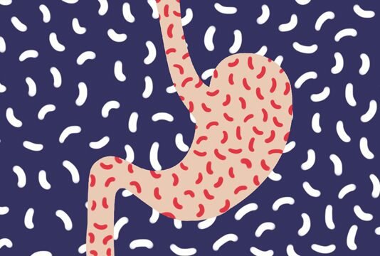 helikobakter pilori vivavita vitajournal
