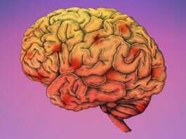 rannjaja diagnostika alcgejmera vivavita vitajournal